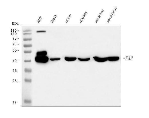 Anti-FAA/FAH Antibody Picoband® Boster Bio