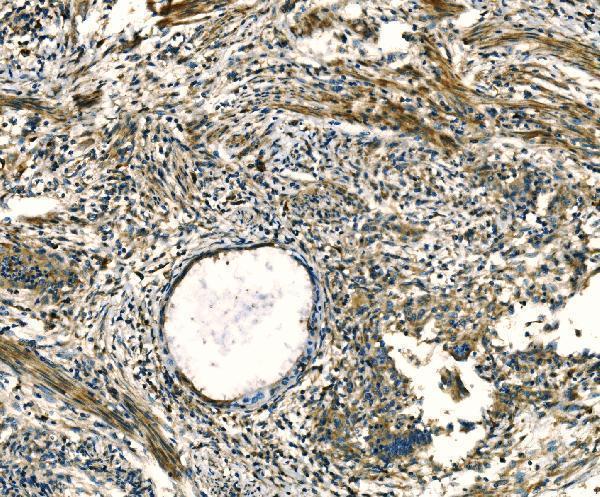 Anti-Apelin/APLN Antibody Boster Bio