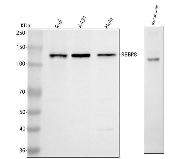 Anti-RBBP8 Antibody Picoband® Boster Bio