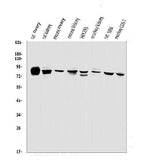 Anti-PHEX Antibody Picoband® Boster Bio