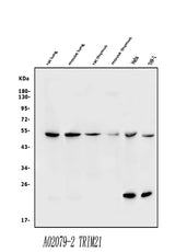 Anti-TRIM21/SS-A Antibody Picoband® Boster Bio