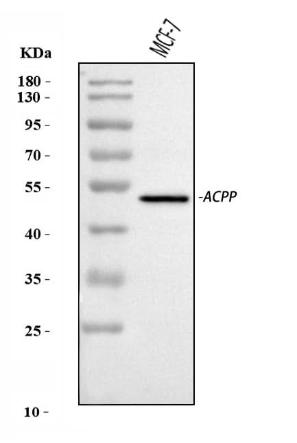 Anti-PAP/ACP3 Antibody Picoband® Boster Bio