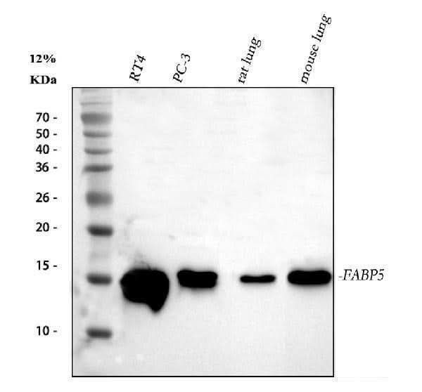 Anti-Fatty Acid Binding Protein 5/FABP5 Antibody Picoband® Boster Bio