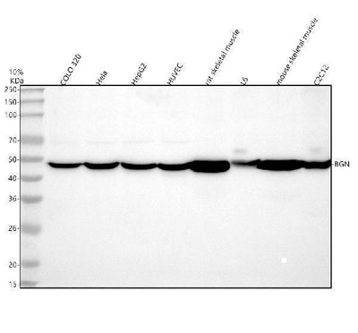 Anti-Biglycan/BGN Antibody Picoband® Boster Bio