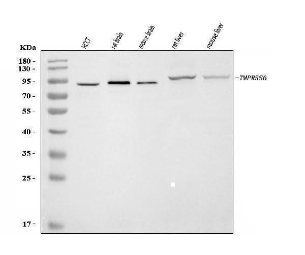 Anti-Matriptase 2/TMPRSS6 Antibody Picoband® Boster Bio