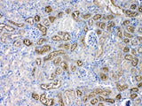 Anti-Angiotensinogen/AGT Antibody Picoband® Boster Bio