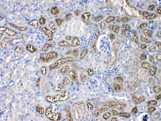 Anti-Angiotensinogen/AGT Antibody Picoband® Boster Bio