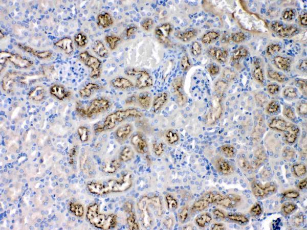 Anti-Angiotensinogen/AGT Antibody Picoband® Boster Bio