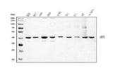 Anti-DHPS/DHS Antibody Picoband® Boster Bio