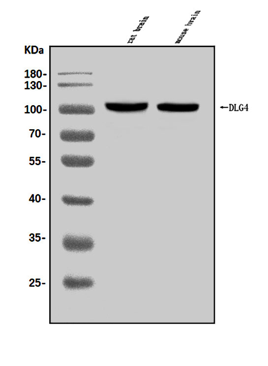 Anti-PSD95/DLG4 Antibody Picoband® Boster Bio
