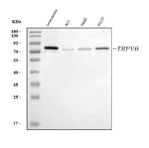 Anti-TRPV6 Antibody Picoband® Boster Bio