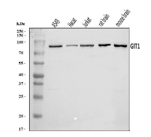 Anti-GIT1 Antibody Picoband® Boster Bio