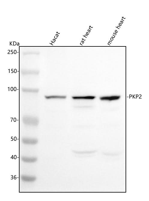 Anti-PKP2 Antibody Picoband® Boster Bio