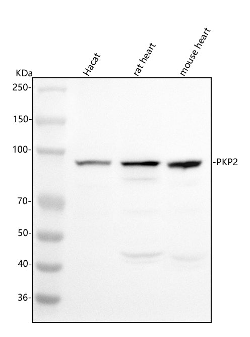 Anti-PKP2 Antibody Picoband® Boster Bio