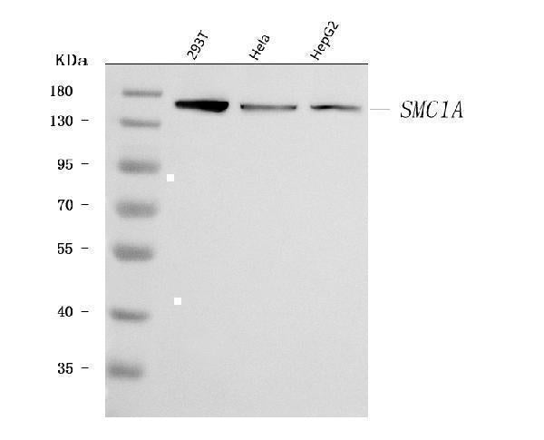Anti-SMC1A Antibody Picoband® Boster Bio