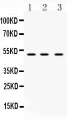 Anti-DR4/TNFRSF10A Antibody Picoband® Boster Bio