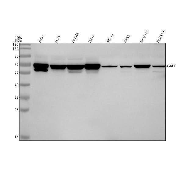 Anti-CKAP4 Antibody Picoband® Boster Bio