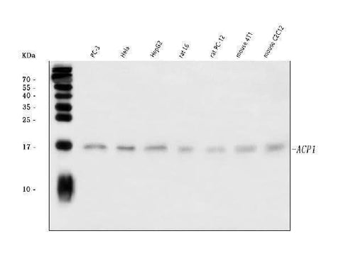 Anti-Acid phosphatase/ACP1 Antibody Picoband® Boster Bio