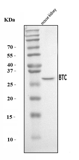Anti-Btc Antibody Picoband® Boster Bio