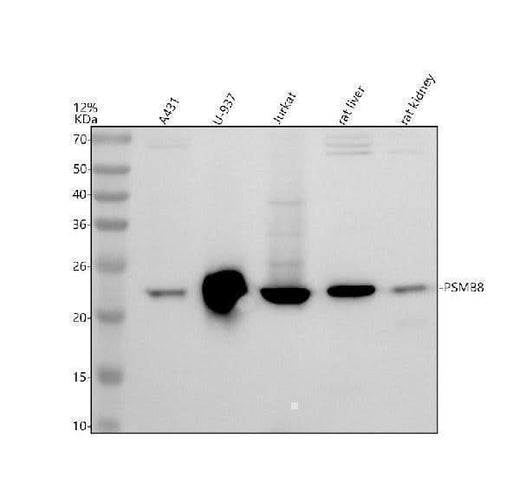 Anti-PSMB8 Antibody Picoband® Boster Bio