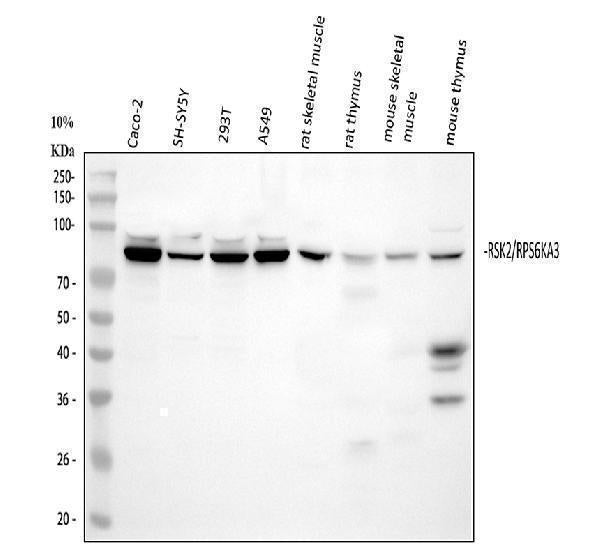 Anti-Rsk 2/MAPKAP Kinase 1b/RPS6KA3 Picoband® Antibody Boster Bio