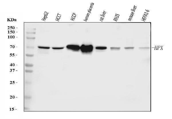 Anti-Hemopexin/HPX Antibody Picoband® Boster Bio