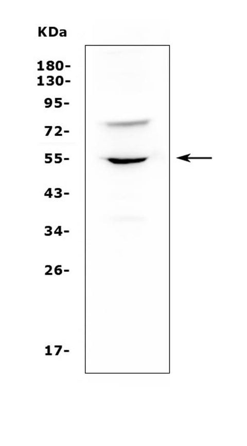 Anti-UGT1A6 Antibody Picoband® Boster Bio