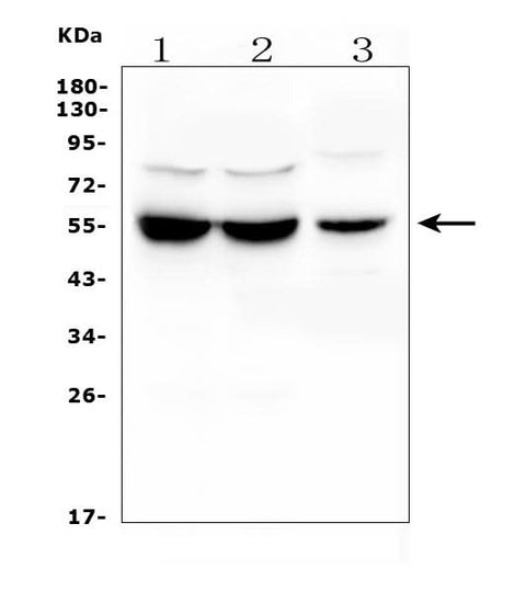 Anti-UGT1A6 Antibody Picoband® Boster Bio