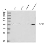 Anti-OLIG2 Antibody Picoband® Boster Bio