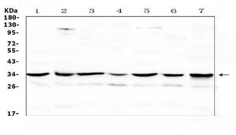 Anti-UCP2 Antibody Picoband® Boster Bio