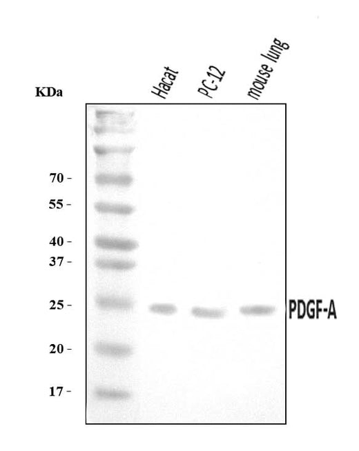 Anti-PDGF AA/PDGFA Antibody Picoband® Boster Bio