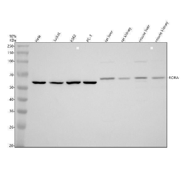 Anti-RORA Antibody Picoband® Boster Bio