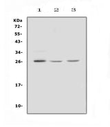 Anti-FGF9 Antibody Picoband® Boster Bio