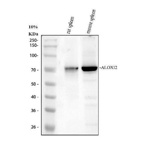 Anti-12 Lipoxygenase/ALOX12 Antibody Picoband® Boster Bio