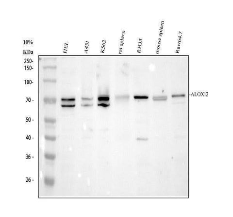 Anti-ALOX12 Antibody Picoband® Boster Bio