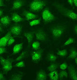 Anti-SUFU Picoband® Antibody Boster Bio