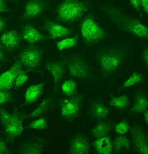 Anti-SUFU Picoband® Antibody Boster Bio