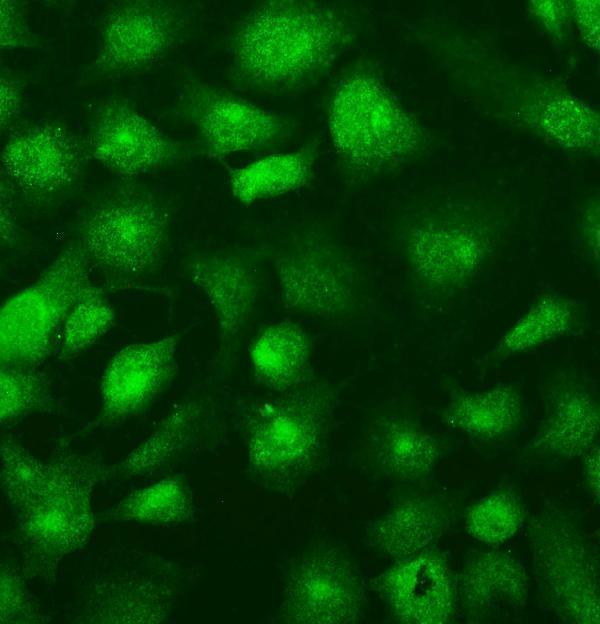 Anti-SUFU Picoband® Antibody Boster Bio