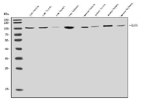 Anti-ClC-5/CLCN5 Antibody Picoband® Boster Bio