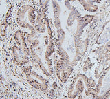 Anti-UBE2I/UBC9 Antibody Picoband® Boster Bio