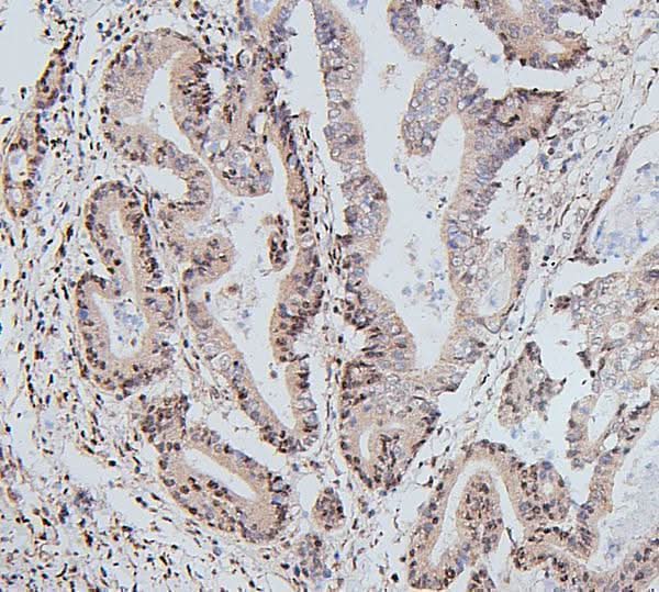Anti-UBE2I/UBC9 Antibody Picoband® Boster Bio