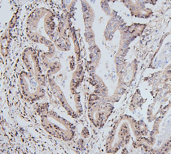 Anti-UBE2I/UBC9 Antibody Picoband® Boster Bio