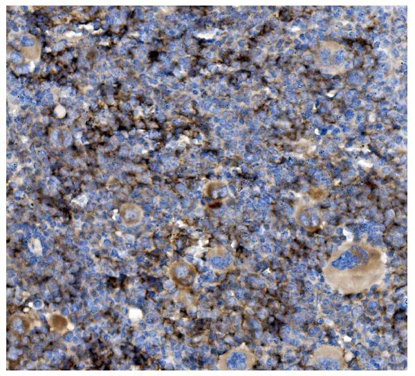 Anti-CD82 Antibody Boster Bio