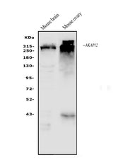 Anti-AKAP12 Antibody Picoband® Boster Bio