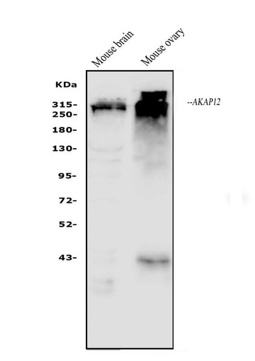 Anti-AKAP12 Antibody Picoband® Boster Bio