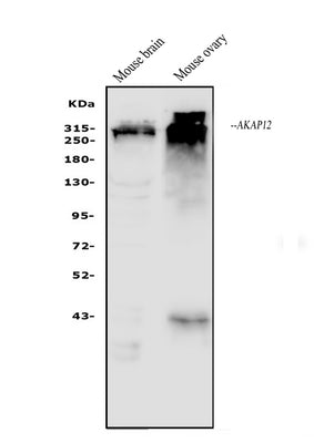 Anti-AKAP12 Antibody Picoband® Boster Bio