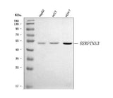 Anti-AACT/SERPINA3 Antibody Picoband® Boster Bio