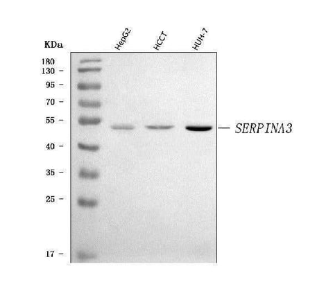 Anti-AACT/SERPINA3 Antibody Picoband® Boster Bio