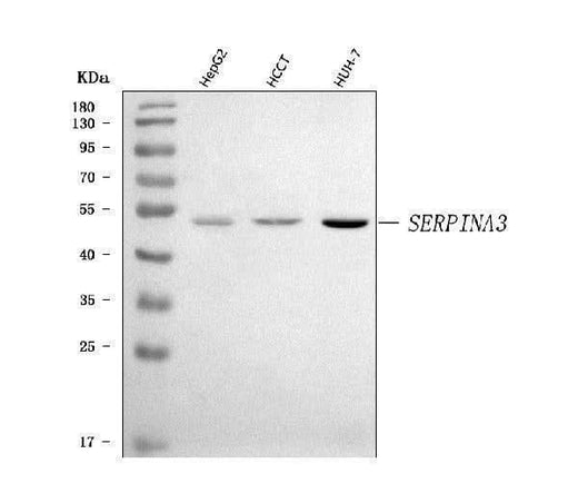 Anti-AACT/SERPINA3 Antibody Picoband® Boster Bio