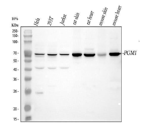 Anti-PGM1 Antibody Picoband® Boster Bio